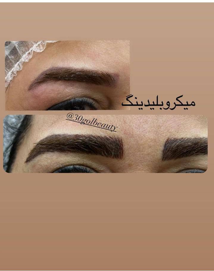 میکروبلیدینگ ابرو